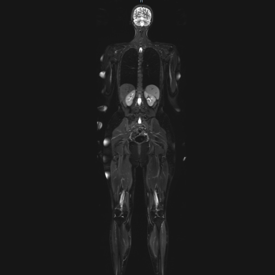 MRT-Scan eines Menschen